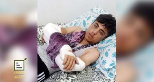 The child "Nazmi" after being assaulted by gunmen - Photo source: exclusive to "Lêlûn"